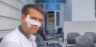 Ош: Неизвестные избили переводчика «Клоопа» Даврона Насибханова